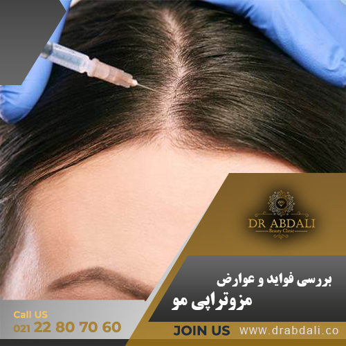 مزوتراپی مو