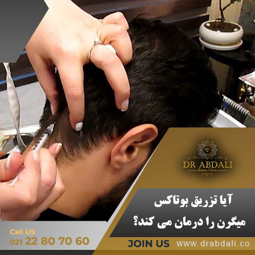 تزریق بوتاکس میگرن- دکتر ابدالی