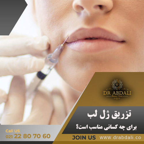 تزریق ژل لب - کلینیک دکتر ابدالی