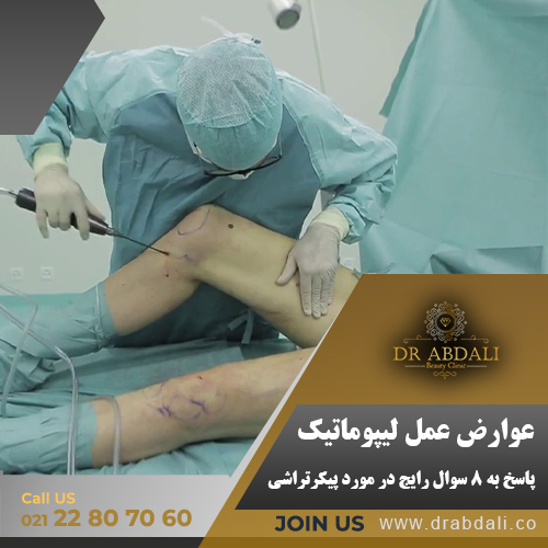 عوارض عمل لیپوماتیک - دکتر ابدالی