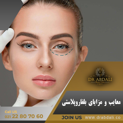 مزایای بلفاروپلاستی - دکتر ابدالی