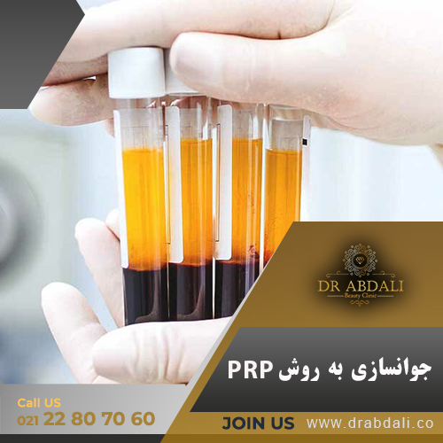 روش PRP - کلینیک دکتر ابدالی