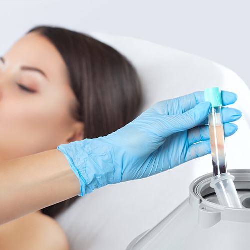 روش PRP - تزریق پلاسما