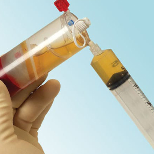 روش PRP - از پلاسما