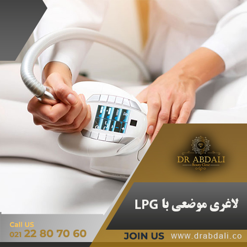 لاغری موضعی با LPG - دکتر ابدالی