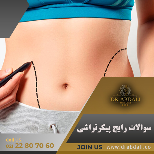 پیکرتراشی - کلینیک دکتر ابدالی