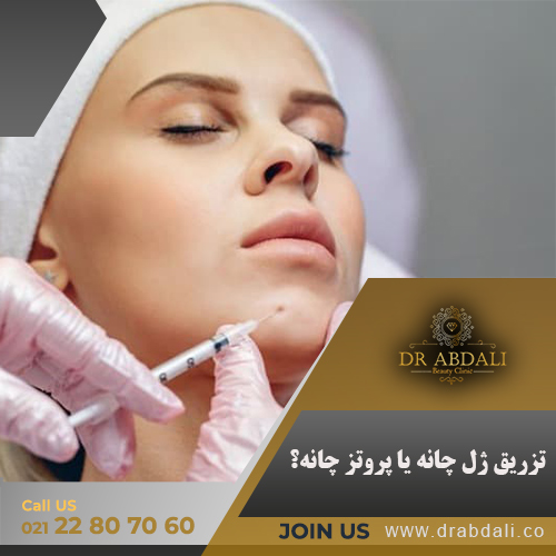 تزریق ژل چانه - کلینیک دکتر ابدالی
