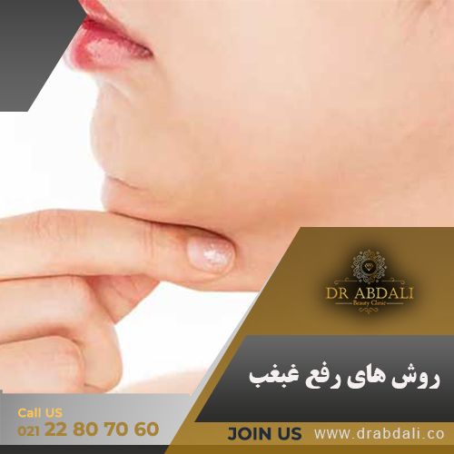 رفع غبغب - دکتر ابدالی