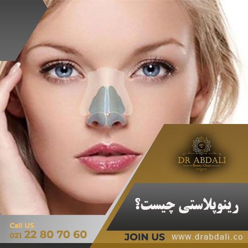 رینوپلاستی - کلینیک دکتر ابدالی