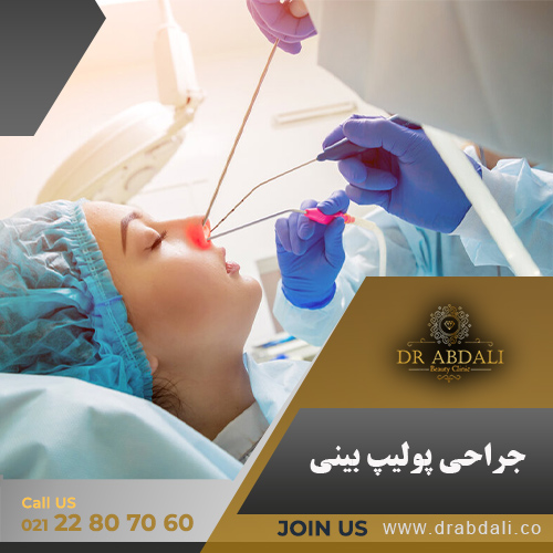 پولیپ بینی - دکتر ابدالی