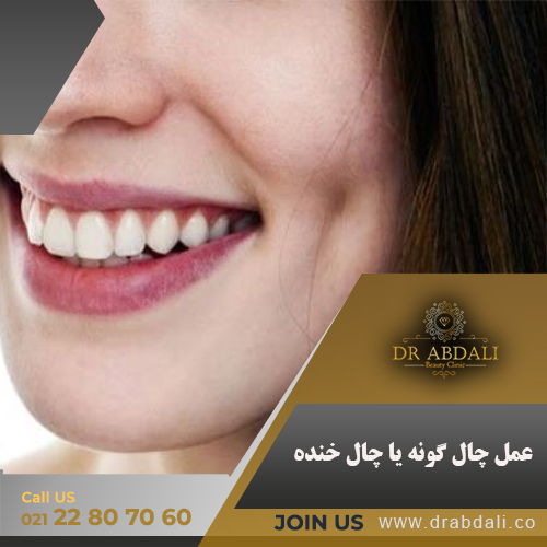 چال گونه - کلینیک دکتر ابدالی
