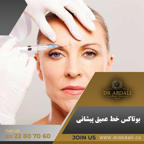 بوتاکس خط عمیق پیشانی - دکتر ابدالی