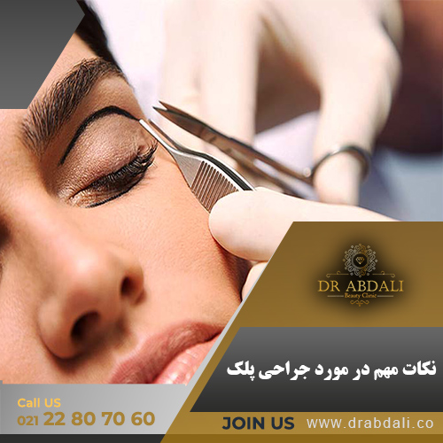 جراحی پلک - دکتر ابدالی