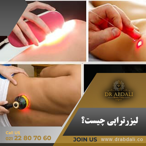 لیزرتراپی چیست - کلینیک دکتر ابدالی