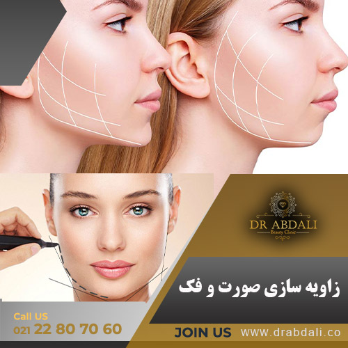 زاویه سازی صورت و فک - کلینیک دکتر ابدالی
