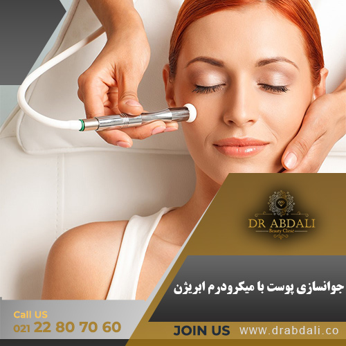 میکرودرم ابریژن - کلینیک دکتر ابدالی