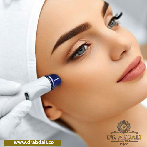 میکرودرم ابریژن - ابزار میکرودرم