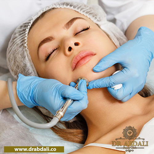 میکرودرم ابریژن - میکرودرم ابریژن چیست
